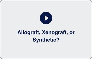 Allograft ICON