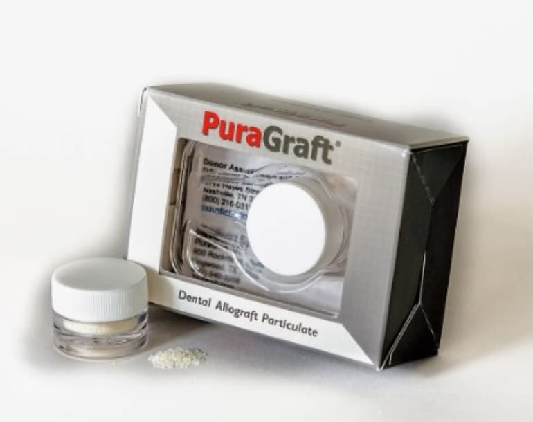 Mineralized Cortical Particulate
