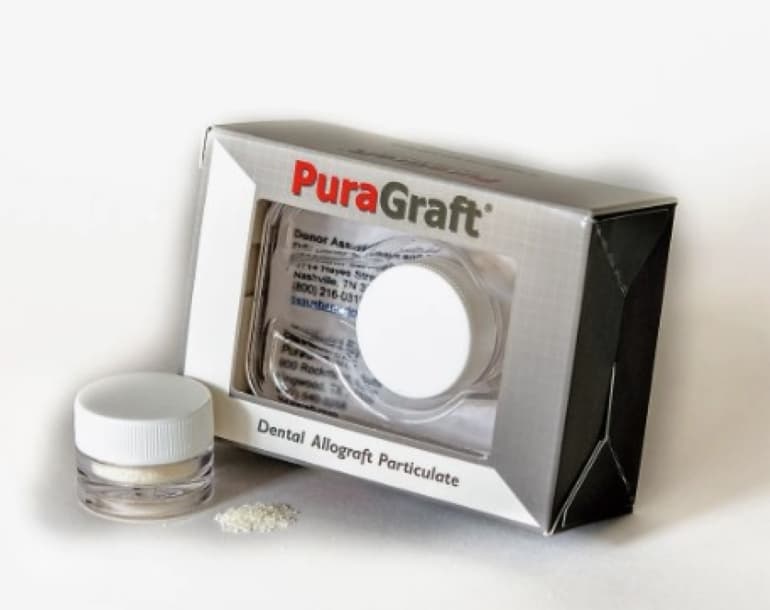 Mineralized/Demineralized Cortical Blend Particulate 250-1000 Microns .5cc